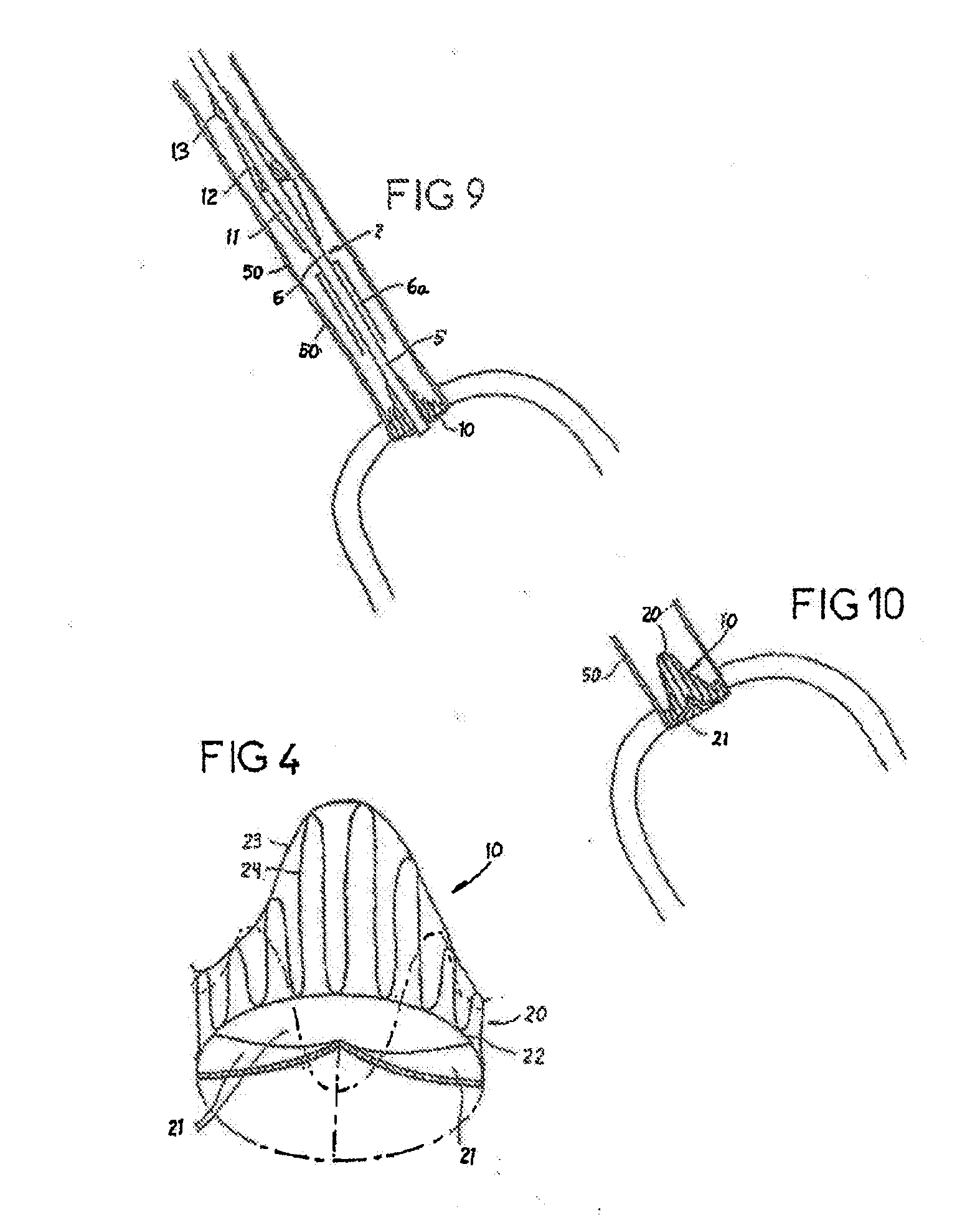 Prosthetic Valve for Transluminal Delivery