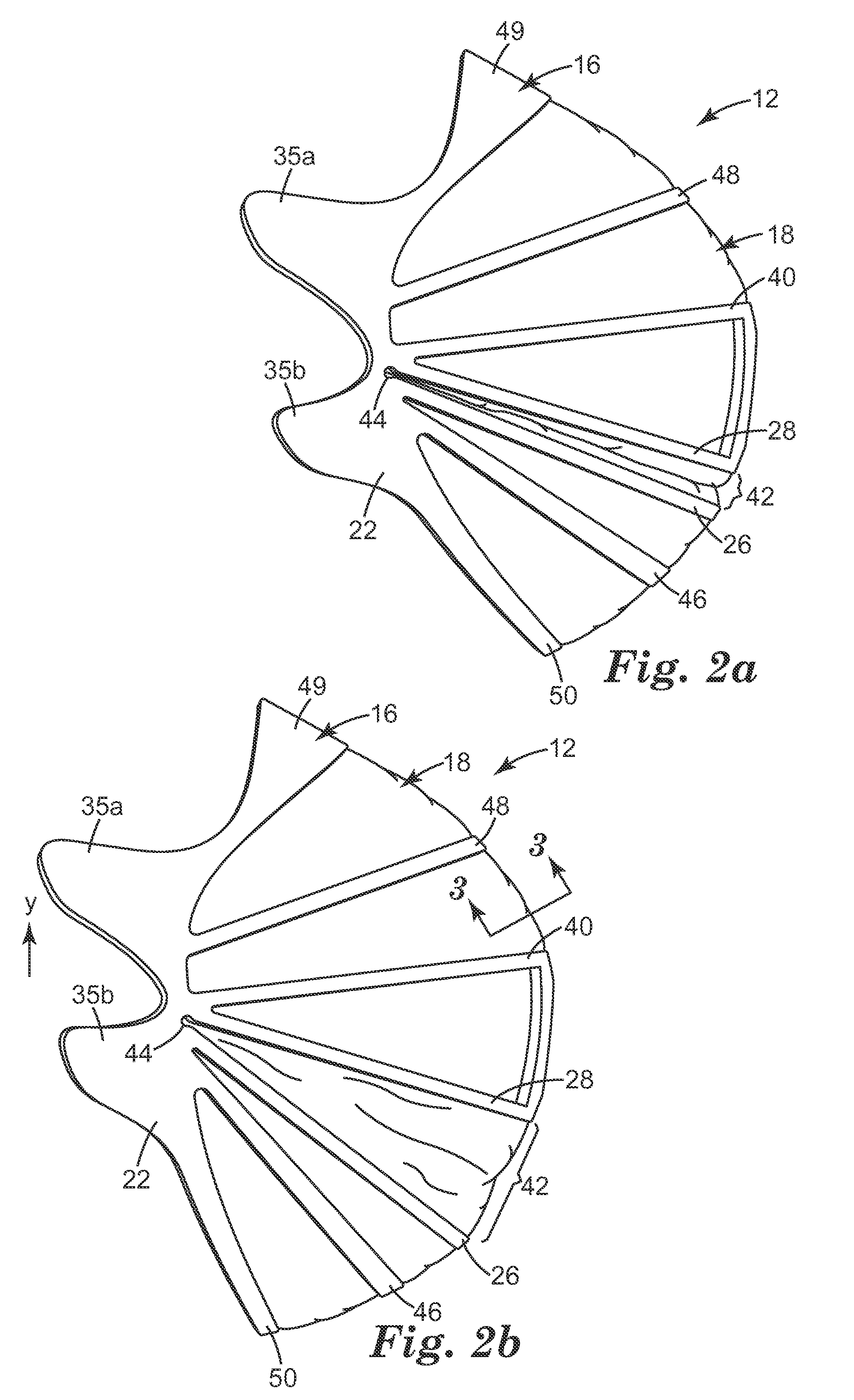 Filtering face-piece respirator that has expandable mask body