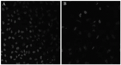 Injectable temperature-sensitive hydrogel artificial lens material having cell membrane biomimetic property and preparation method thereof