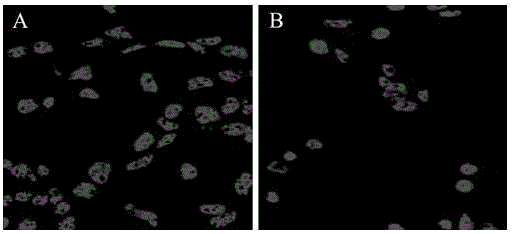 Injectable temperature-sensitive hydrogel artificial lens material having cell membrane biomimetic property and preparation method thereof