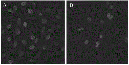 Injectable temperature-sensitive hydrogel artificial lens material having cell membrane biomimetic property and preparation method thereof