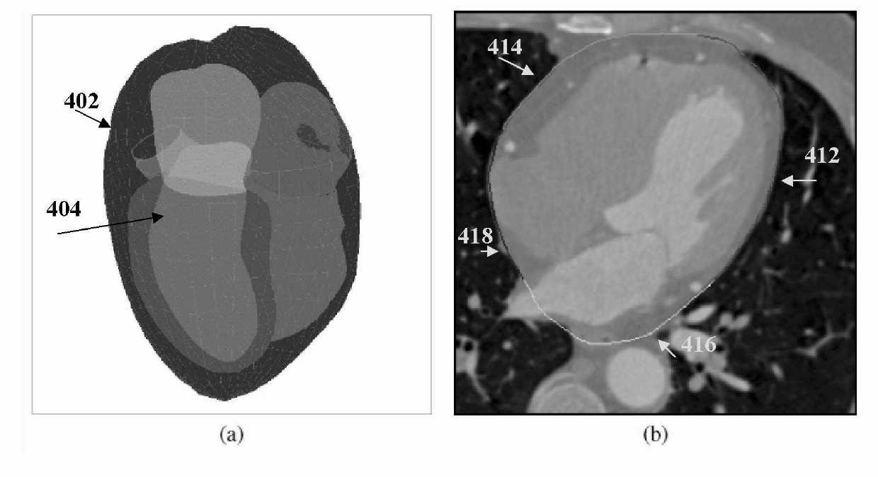 Method and system for heart isolation in cardiac computed tomography volumes