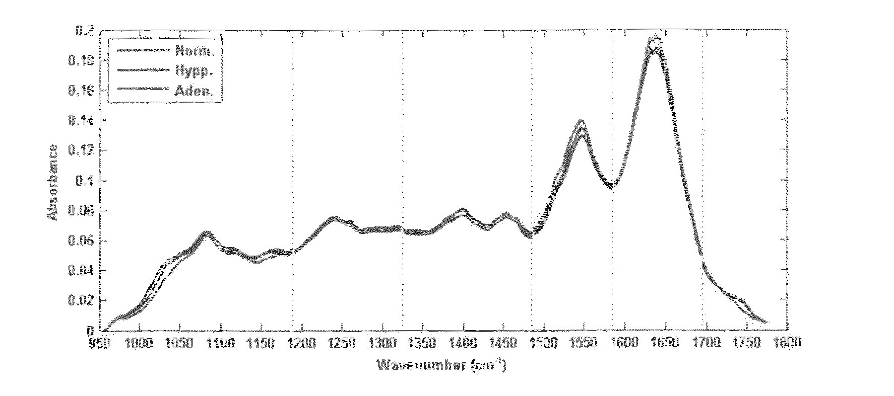 Process and device for detection of precancer tissues with infrared spectroscopy