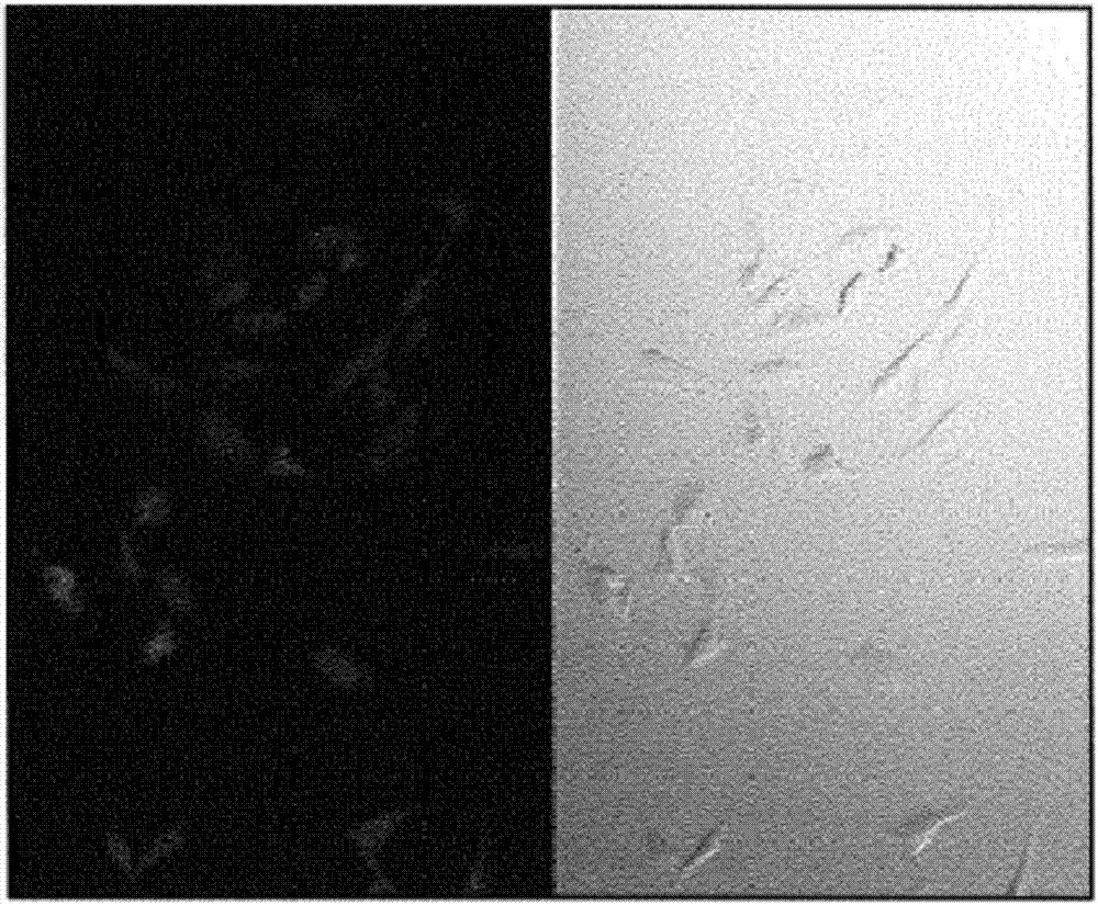 Targeting intracellular copper ions for inhibiting angiogenesis using nanoparticles of ternary inorganic metal sulfide m1m2s4 (m1, independently, is mg, ca, mn, fe, or zn; m2=mo or w) compounds to treat metastatic cancer