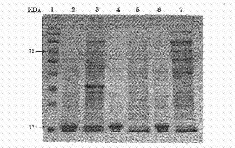 Preparation method for human thymosin beta 4 two-string body protein