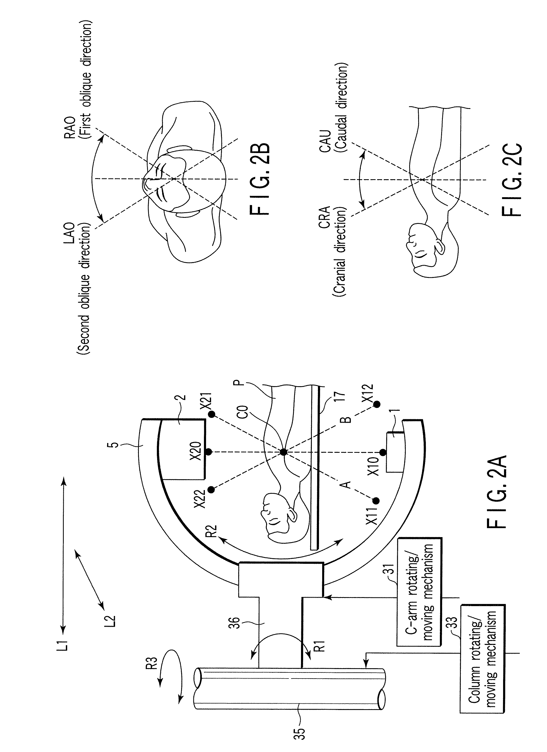 X-ray diagnostic apparatus