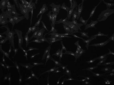 Separation and culture method of human retina Muller cells