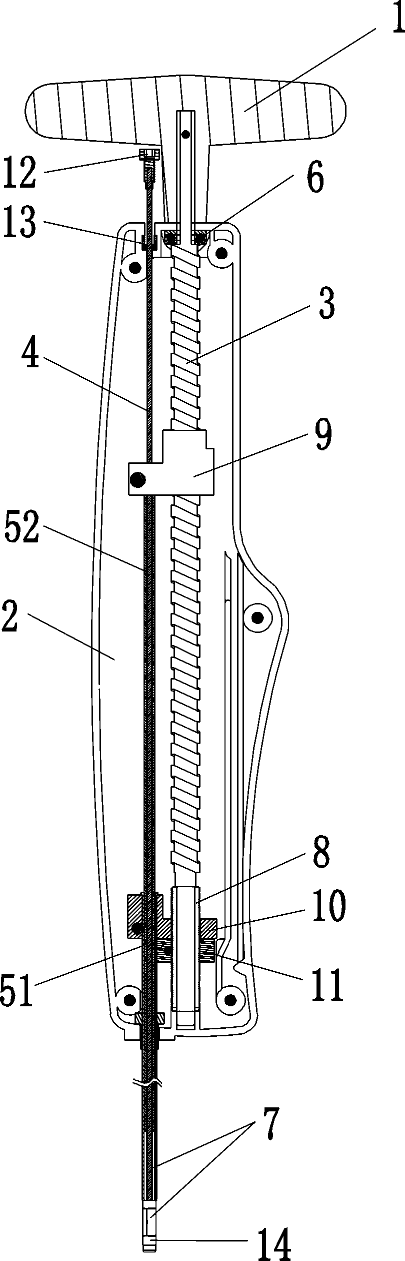 percutaneous distraction vertebroplasty system