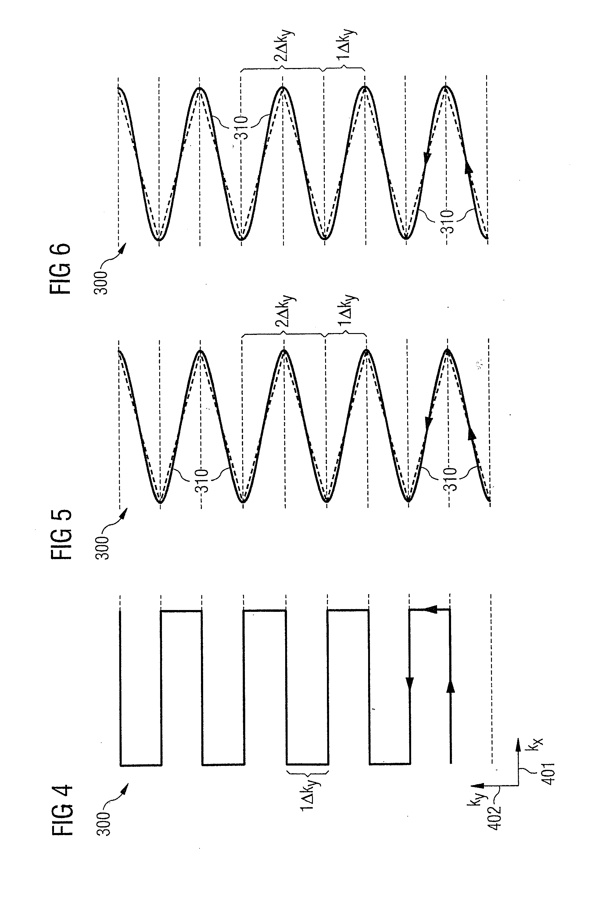 Method and magnetic resonance apparatus for echo planar imaging with data entry into k-space along a zigzag trajectory