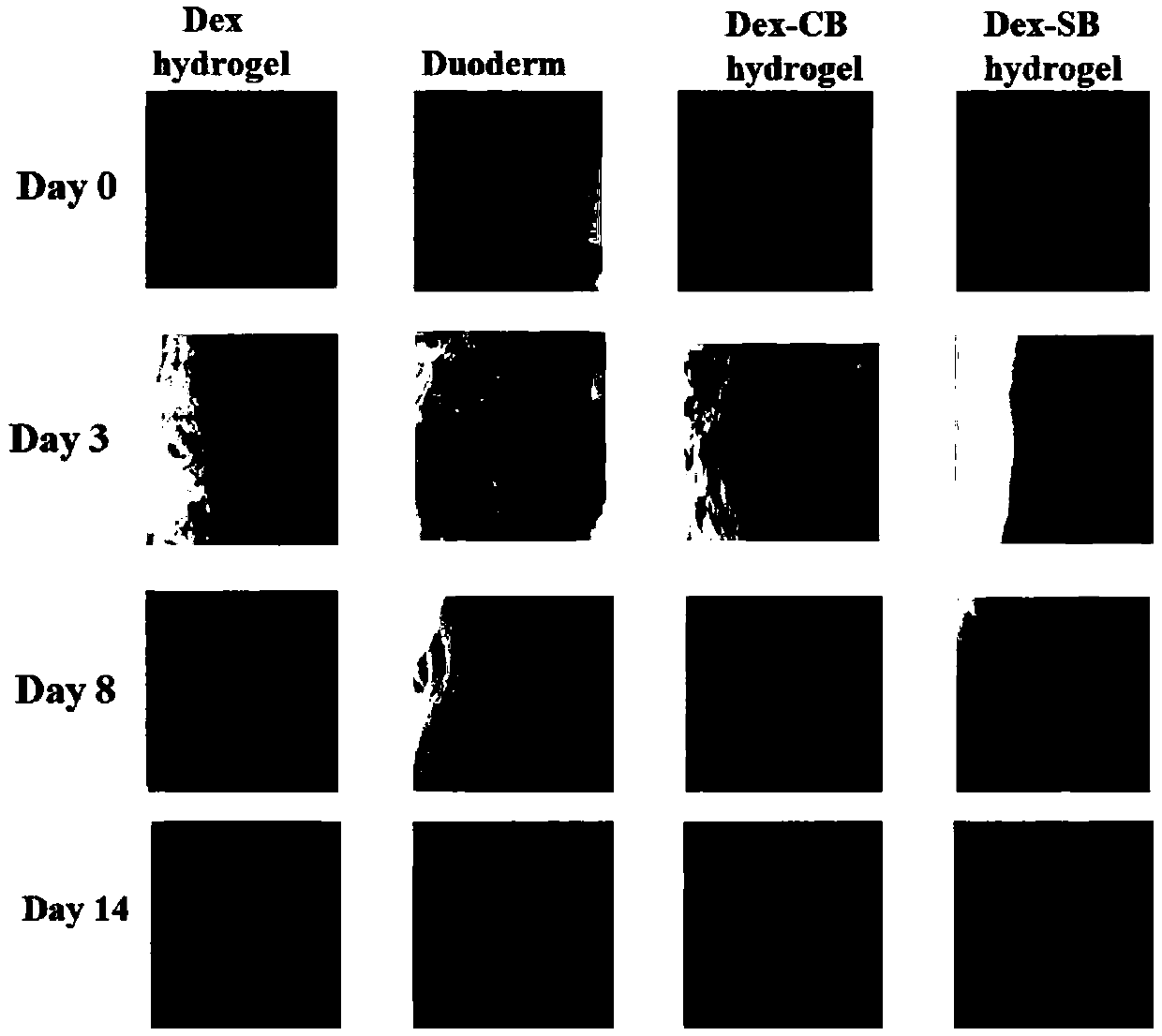 Amphoteric glucan hydrogel and application thereof