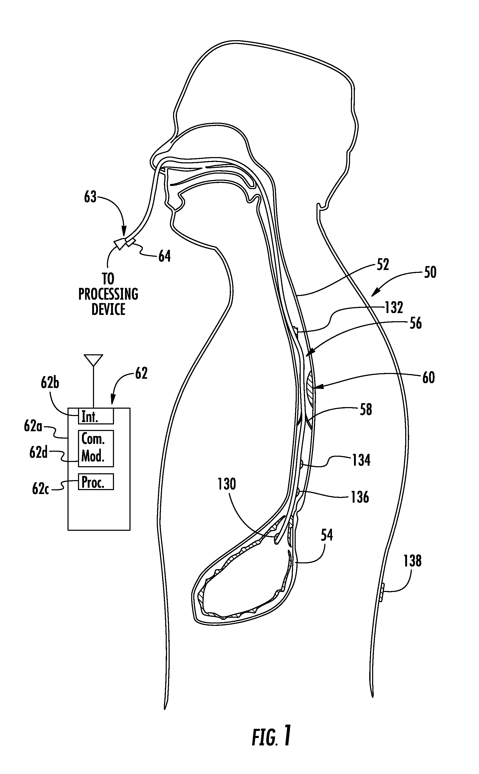 Device with active valve to block emesis and reflux blockage device and associated system and method