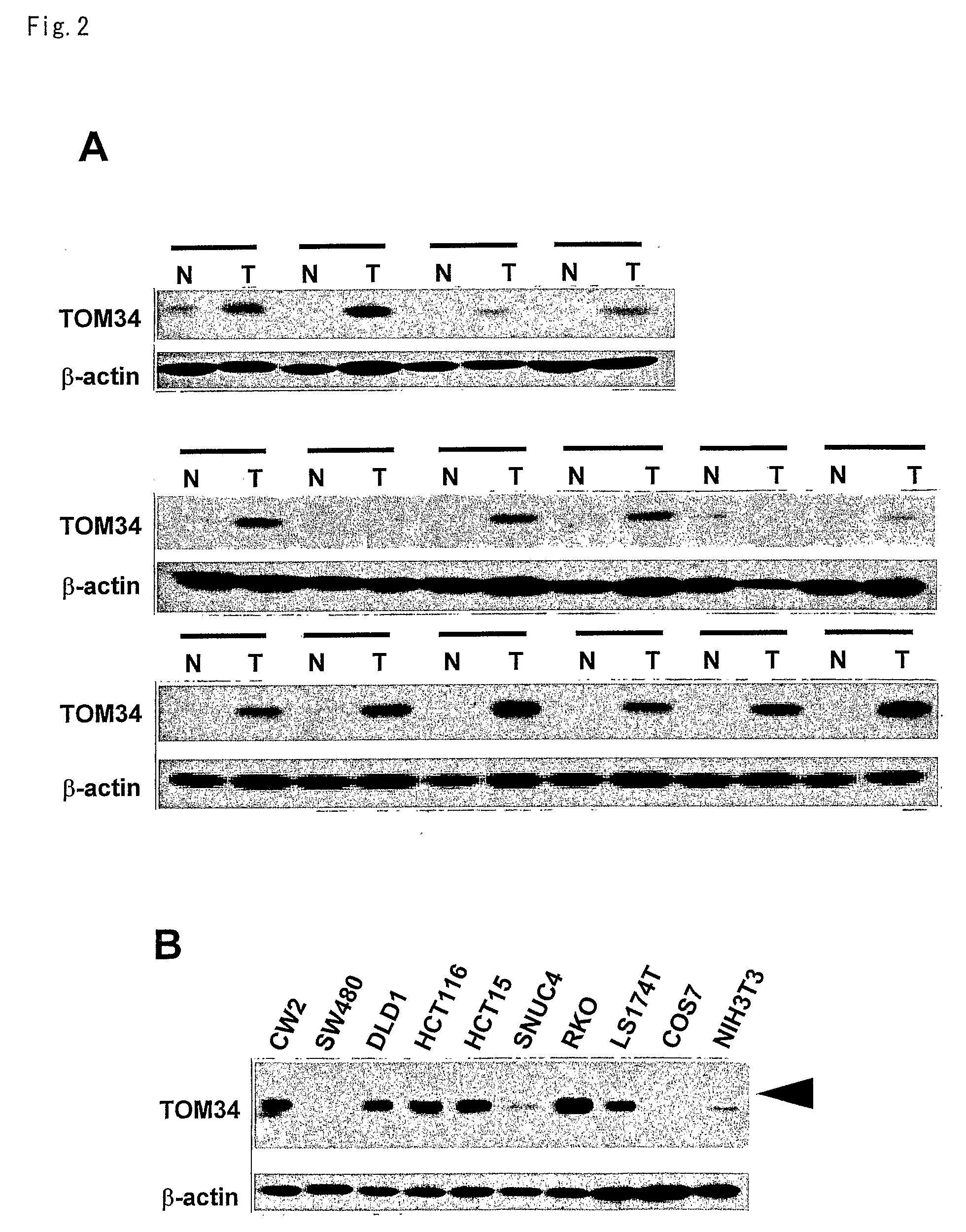 Colon cancer related gene tom34