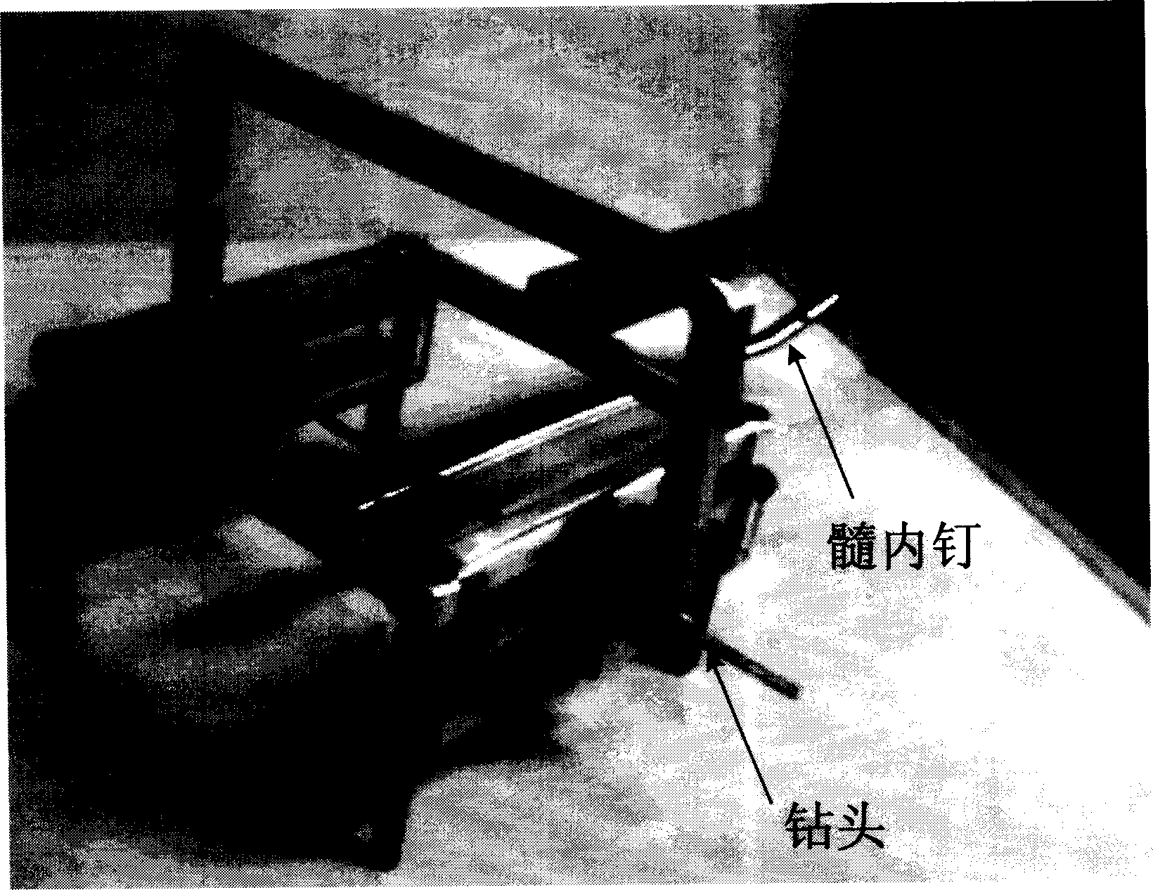 Computer aided system for locking far terminal of intramedullary nail