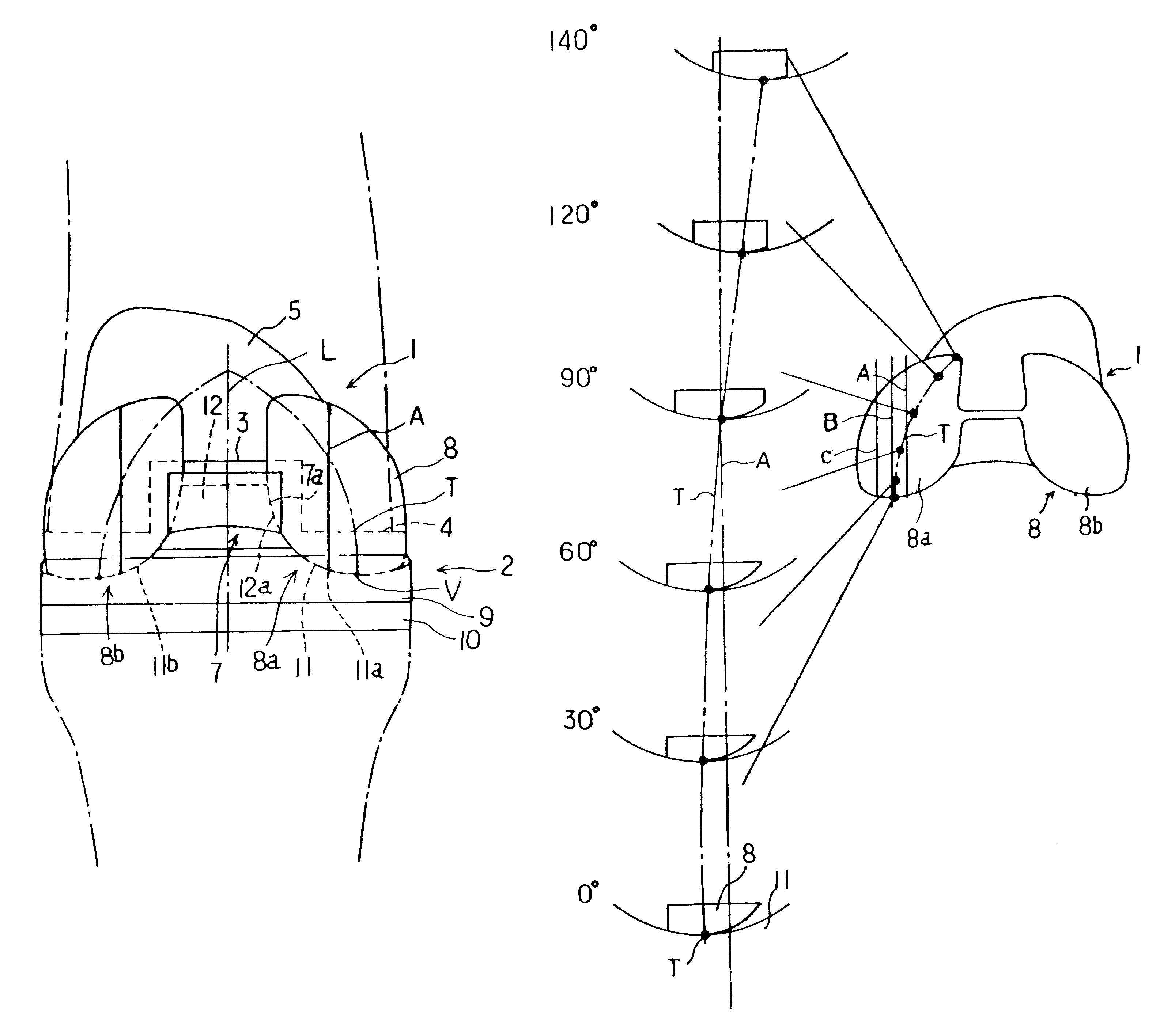 Artificial knee joint