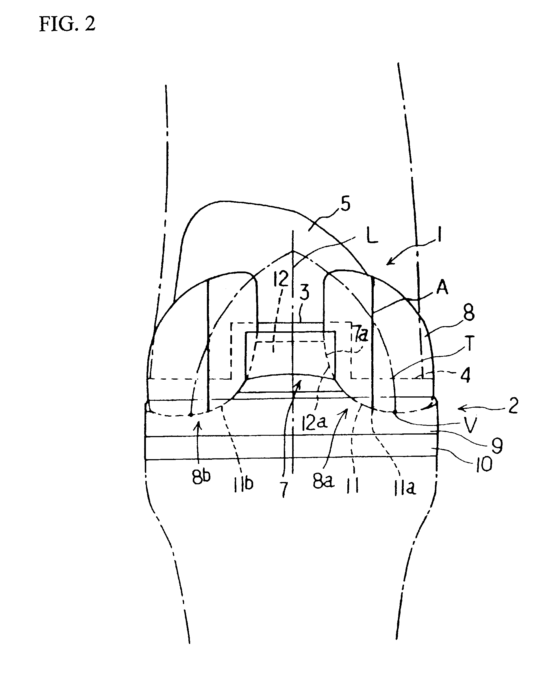 Artificial knee joint