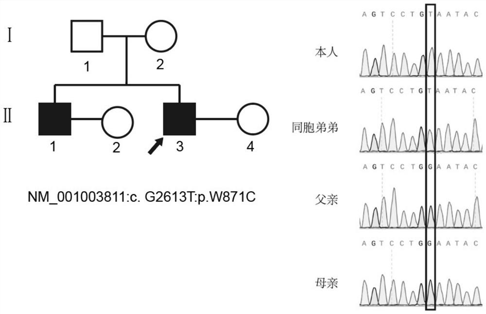 Application of TEX11 gene pathogenic mutation in preparation of diagnostic kit for detecting non-obstructive azoospermia