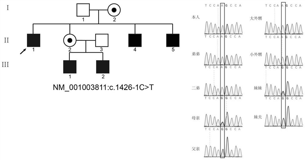 Application of TEX11 gene pathogenic mutation in preparation of diagnostic kit for detecting non-obstructive azoospermia