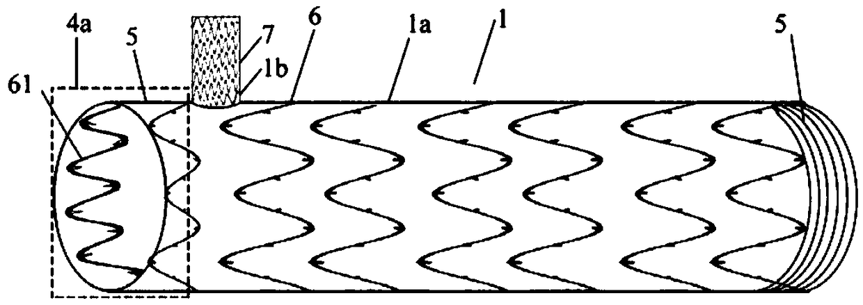 A combined intraoperative on-demand blocking branch stent vessel