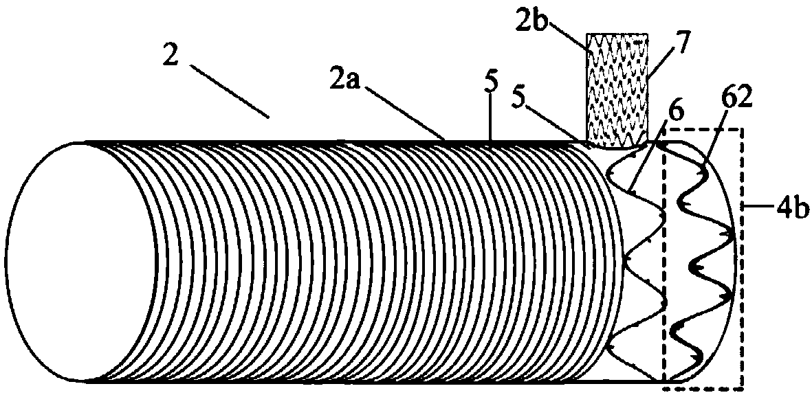 A combined intraoperative on-demand blocking branch stent vessel