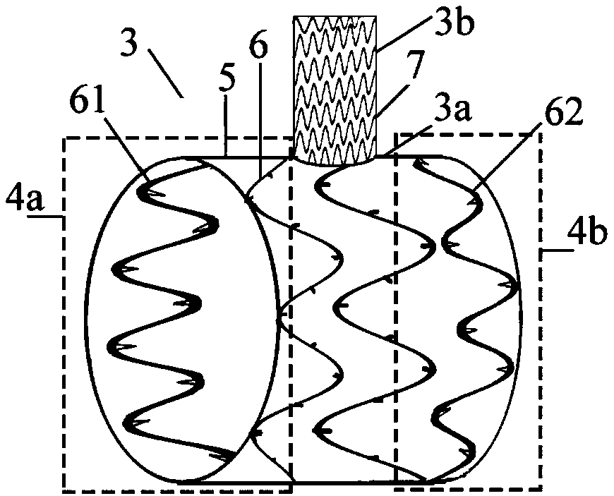 A combined intraoperative on-demand blocking branch stent vessel