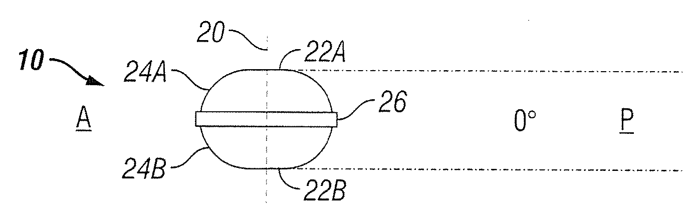 Artificial Spinal Disc