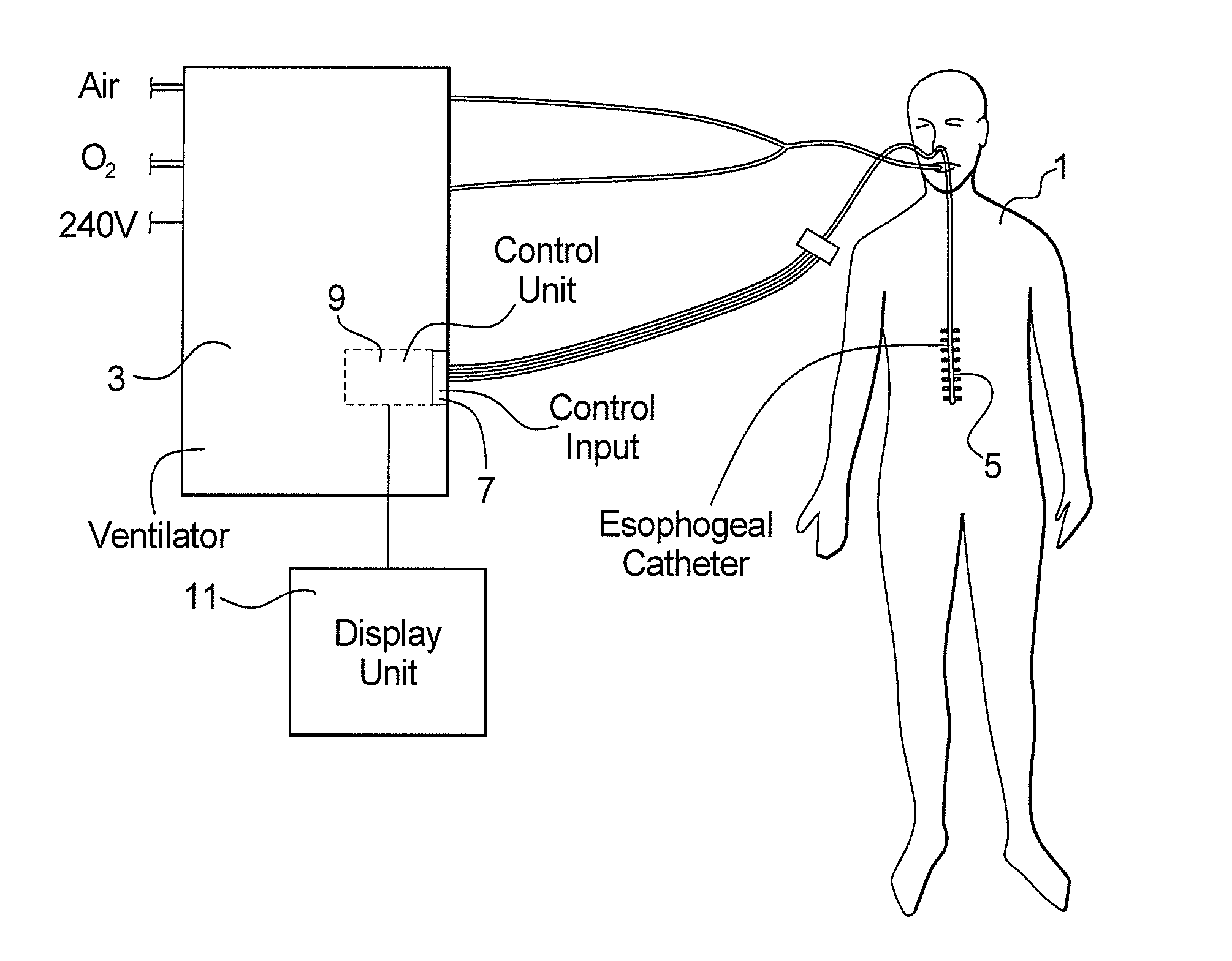 Control unit and display unit for an EMG controlled ventilator