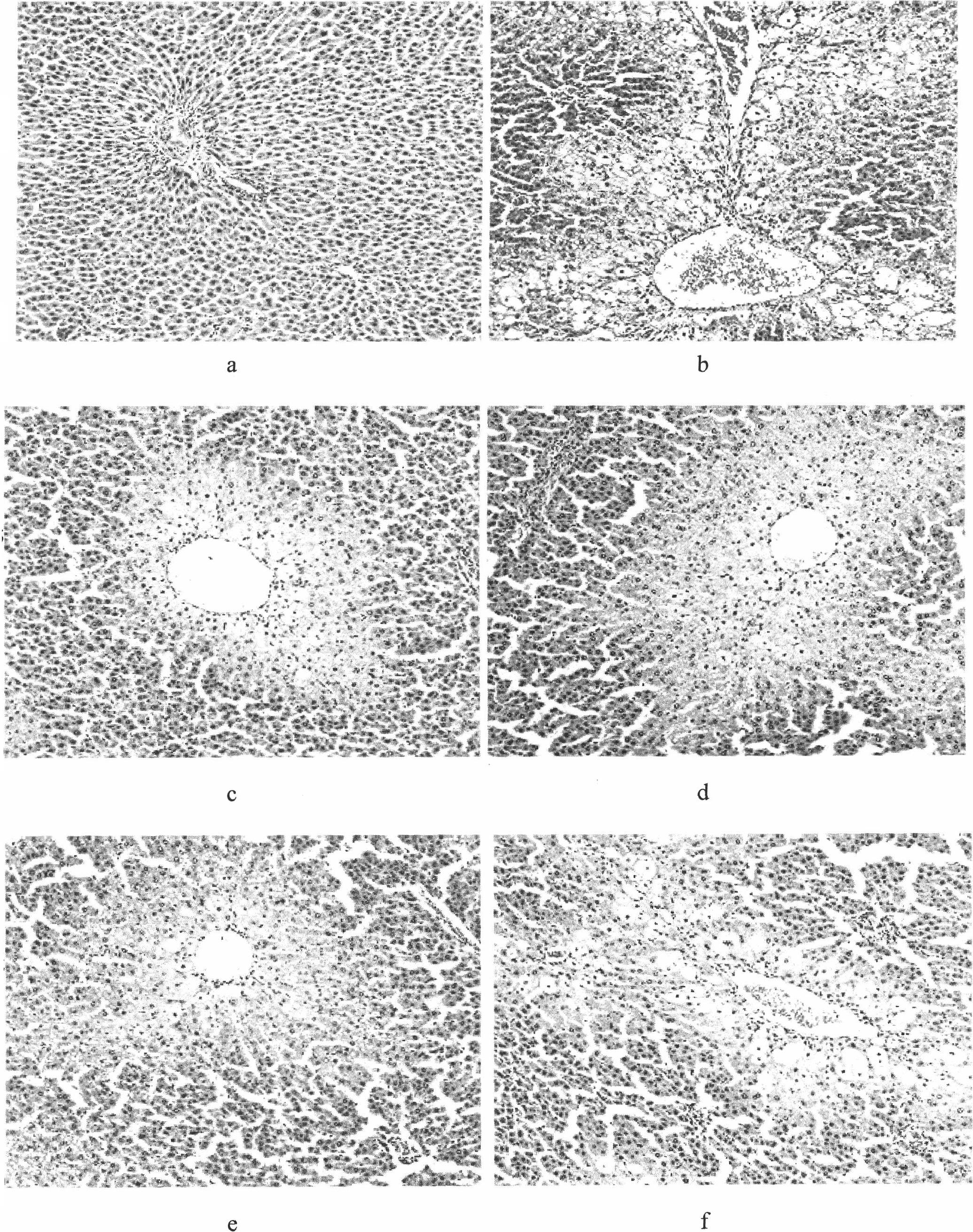 Tibetan capillaris extract and preparation method, pharmaceutical composition and use thereof