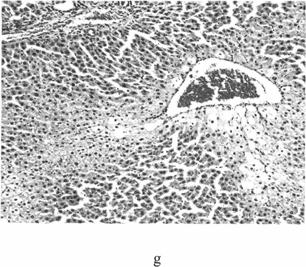 Tibetan capillaris extract and preparation method, pharmaceutical composition and use thereof