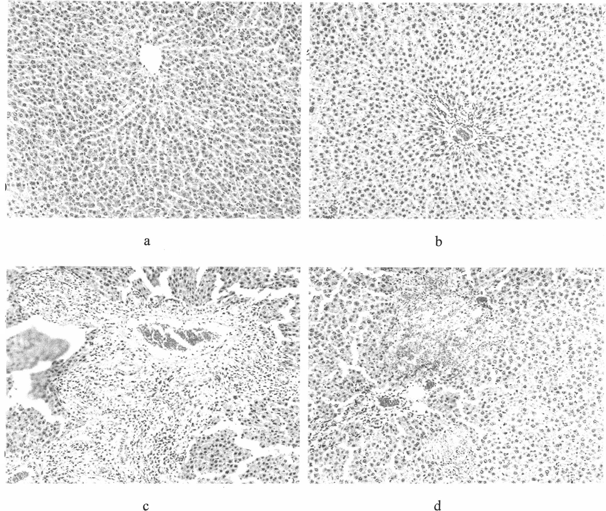 Tibetan capillaris extract and preparation method, pharmaceutical composition and use thereof