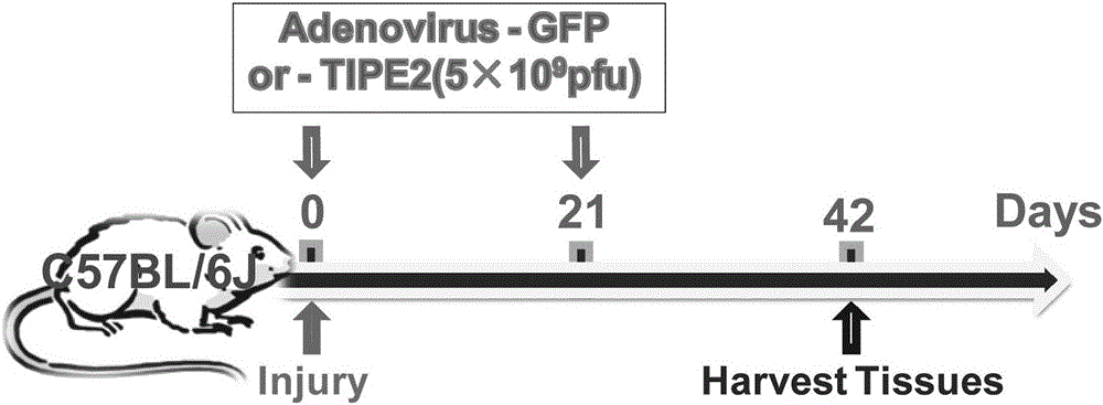 Application of immunomodulatory molecule tipe2 in the preparation of drugs for the treatment of angioproliferative diseases