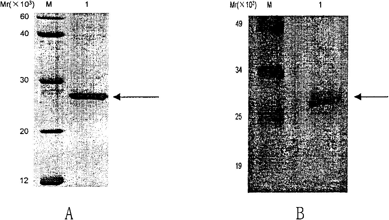 IgY antibody for resisting botulinus toxin substrate peptide SubA as well as preparation method and application thereof