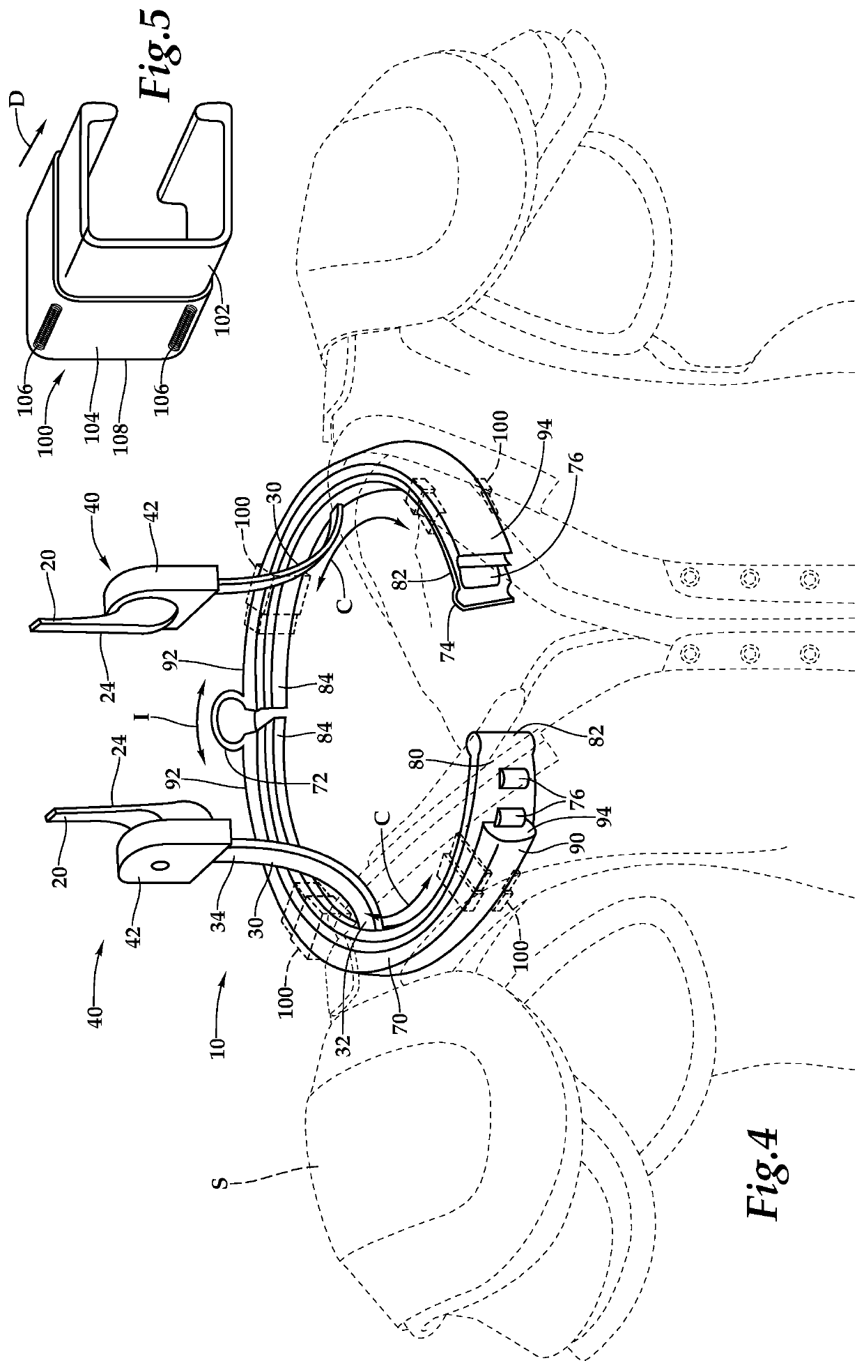 Helmet force mitigation system