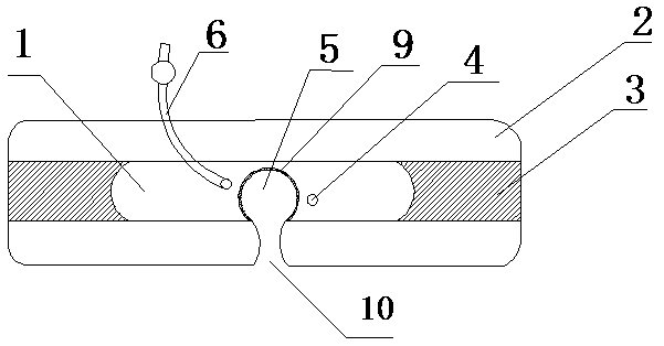 Gum protective bite block applied to endotracheal intubation