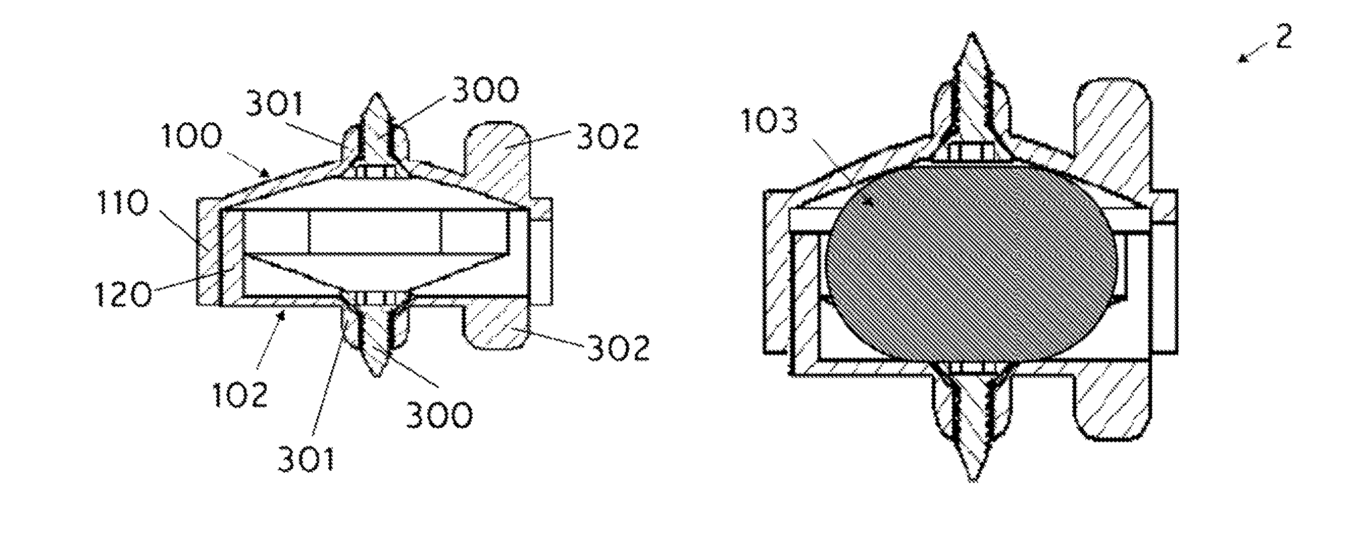 Artificial disc prosthesis for replacing a damaged nucleus