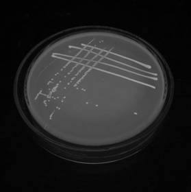 Method for evaluating migration risk of antibiotic drug resistance gene