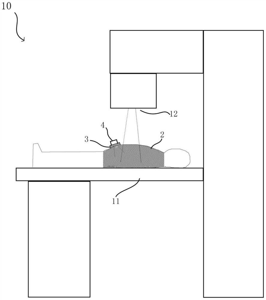 Tumor and organ position ultrasonic image real-time monitoring system for radiotherapy