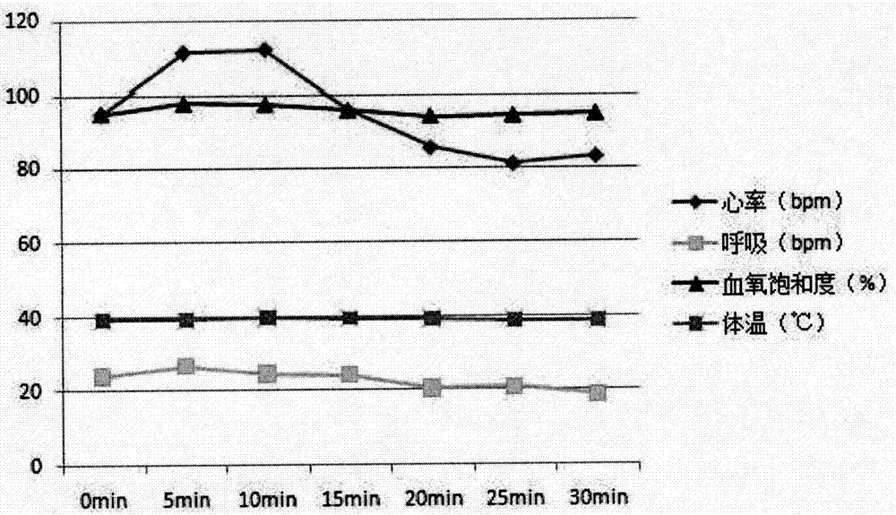 Compound dexmedetomidine injection agent for dogs and preparation method thereof