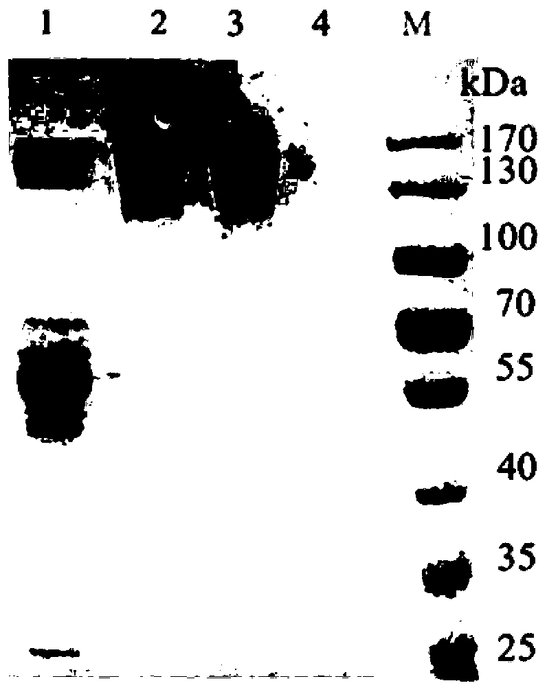 O antigen affinity medium and preparation method and application thereof