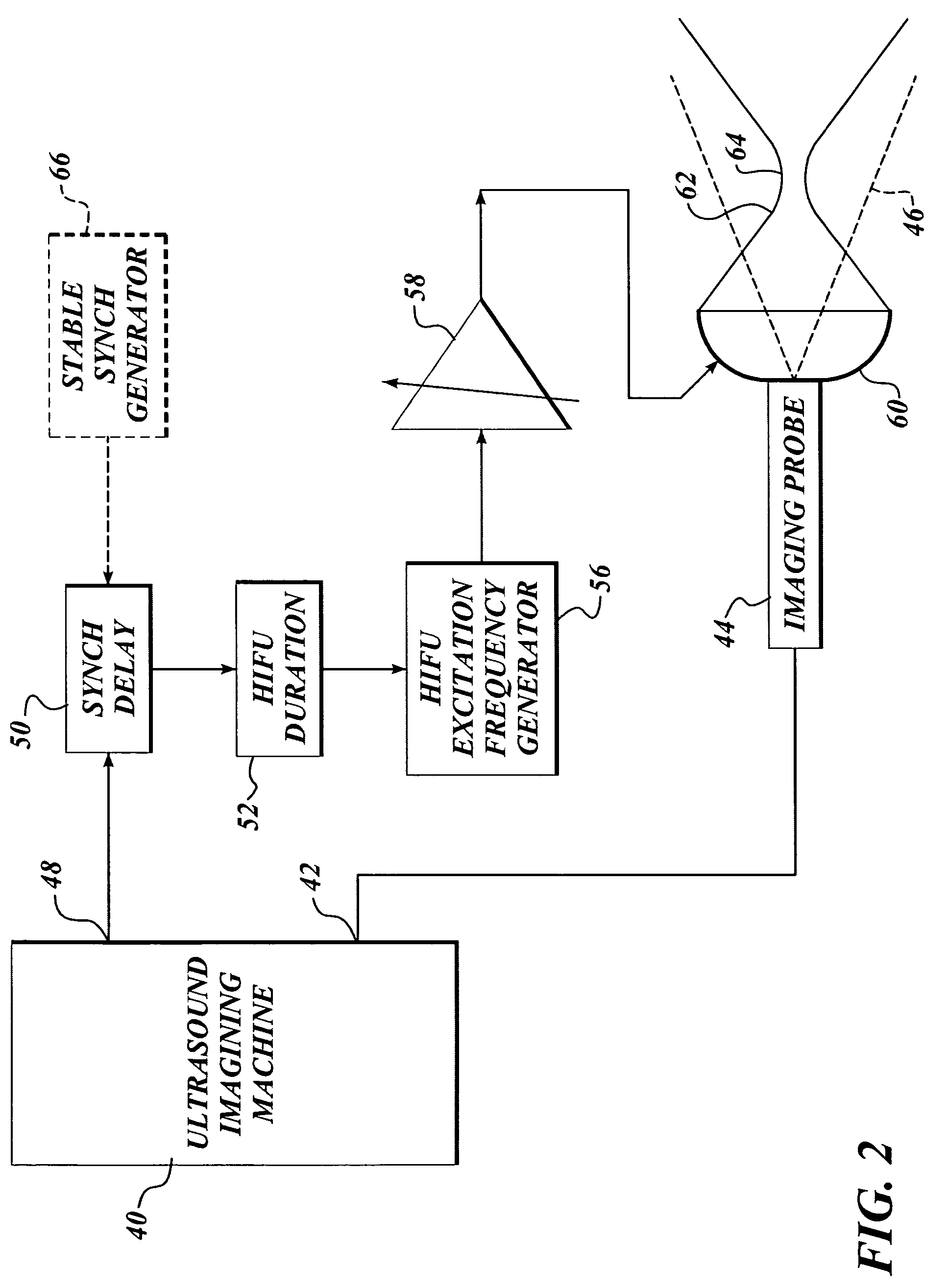 Ultrasound guided high intensity focused ultrasound treatment of nerves