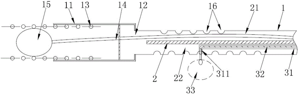 Balloon following device for stents