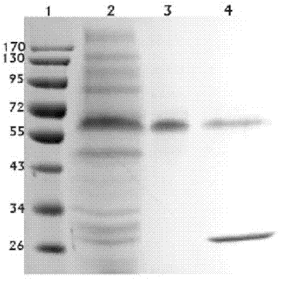 Acidic cellulase EGI, gene thereof and application thereof