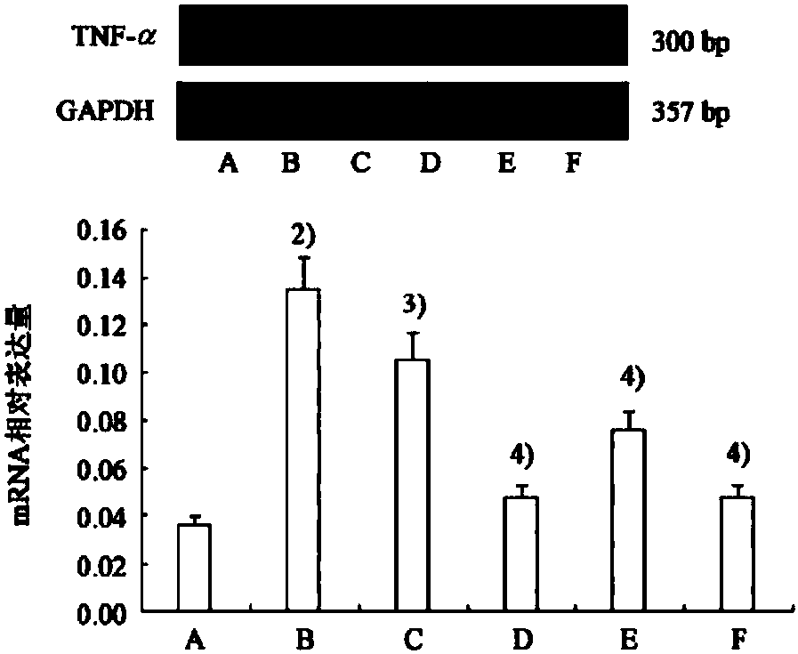 Liver injury treating pharmaceutical composition