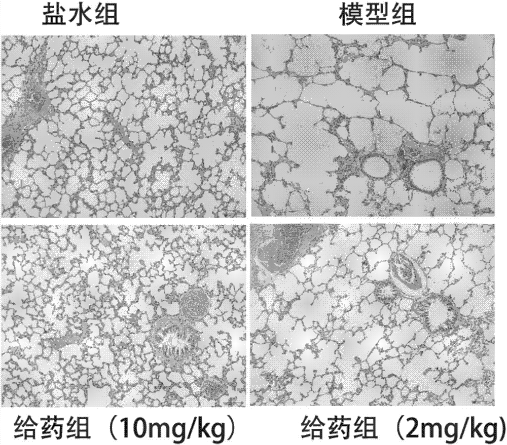 Application of euphorbia jolkini lactone B derivative in drug for treating chronic obstructive pulmonary disease