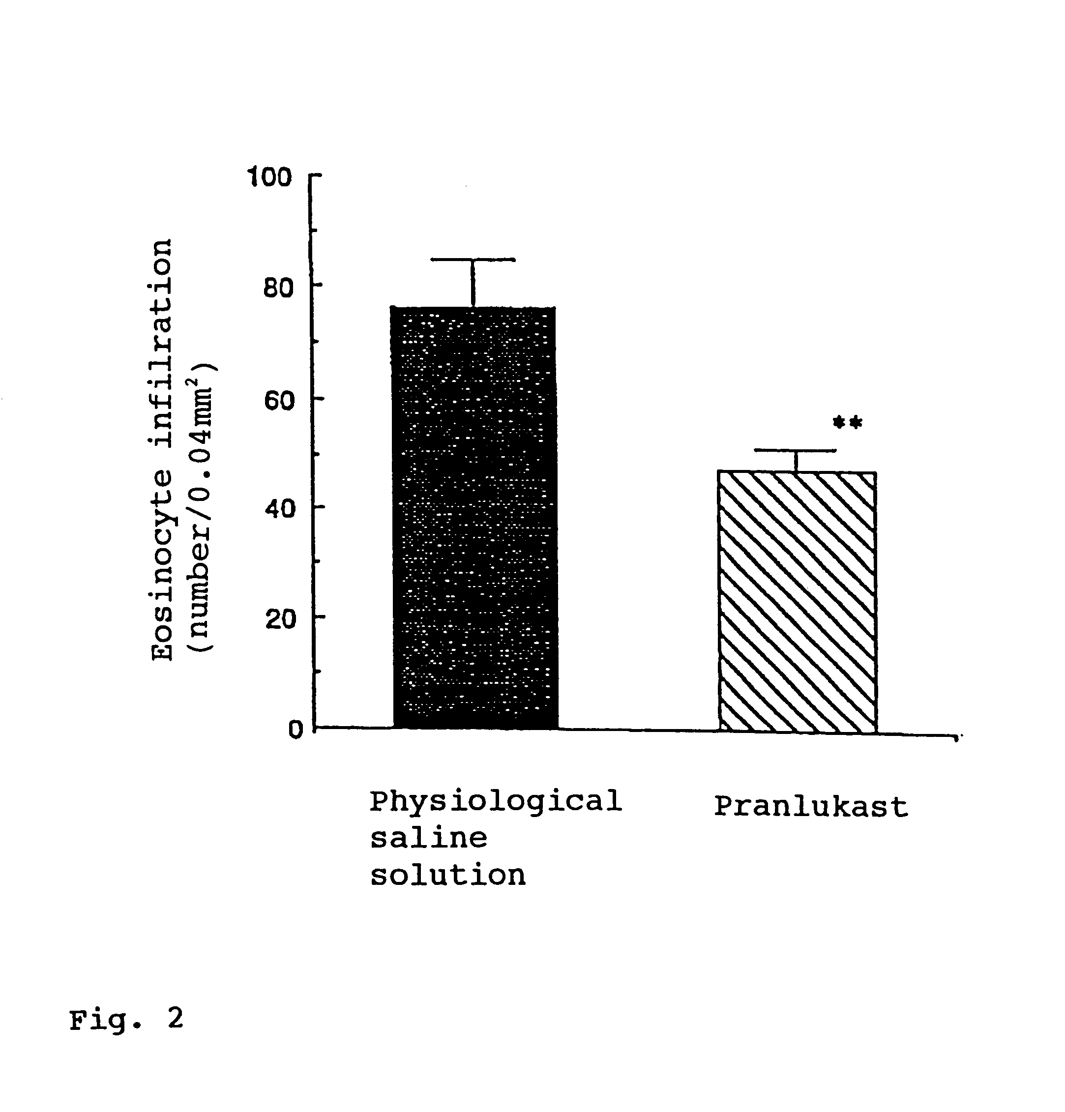 Aqueous liquid pharmaceutical composition containing as main component benzopyran derivative