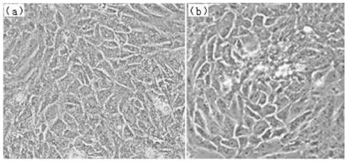 The method of culture and oxidative stress model establishment of epithelial cells of oviduct enlargement of laying hens