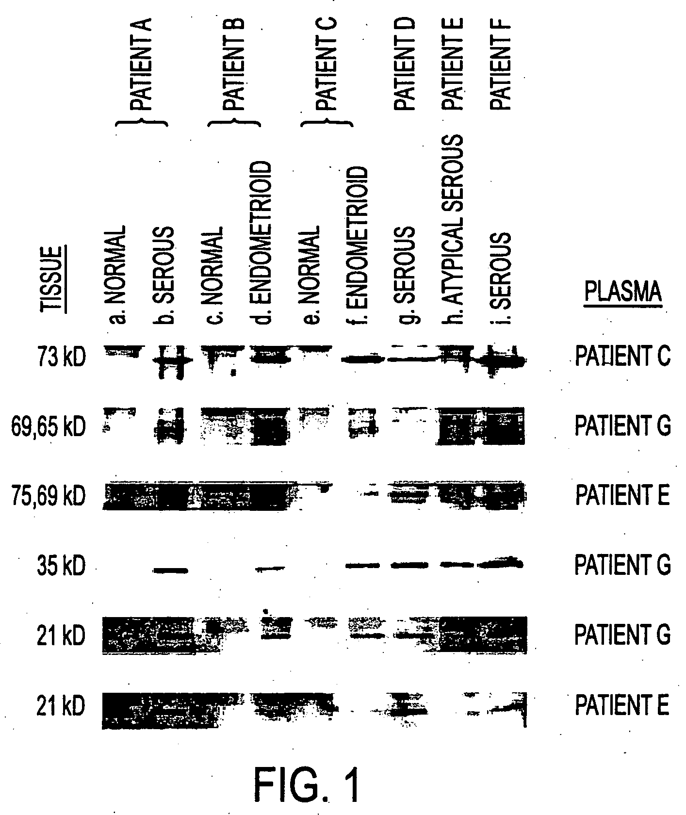 Immunogenic ovarian cancer genes