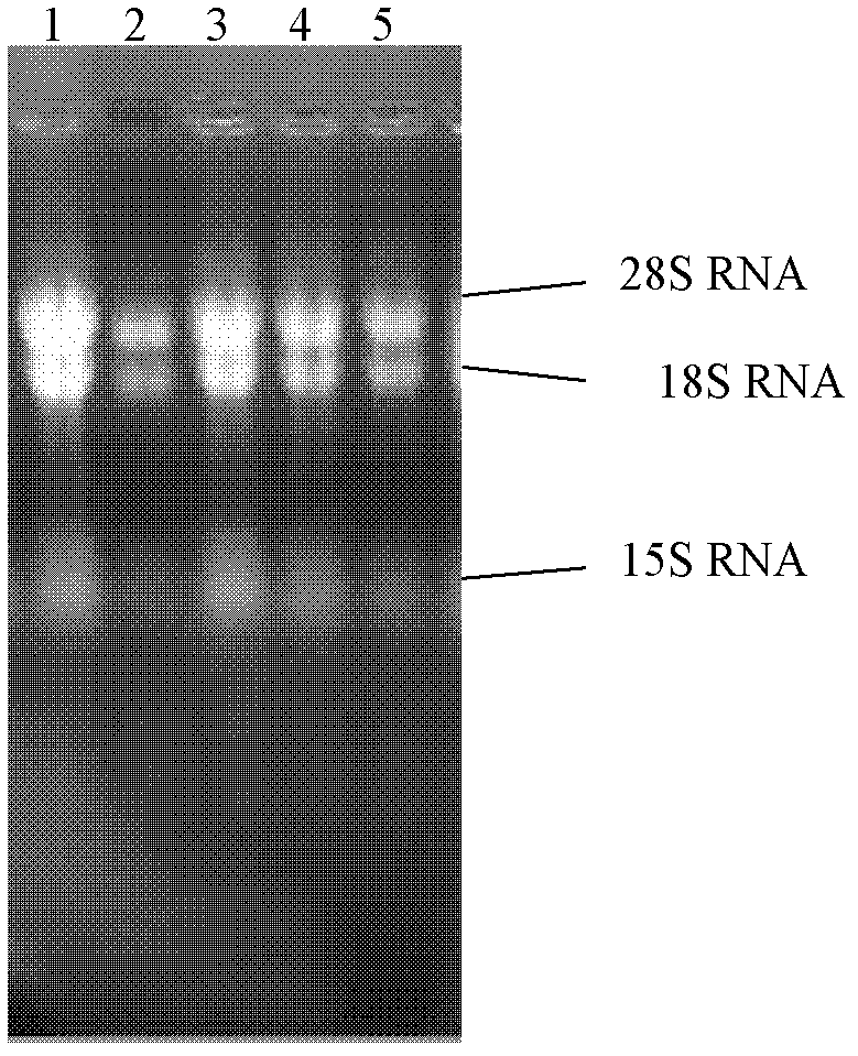 Cordycepin anabolism-related enzyme from cordyceps sinensis hirsutella sinensis, gene and application