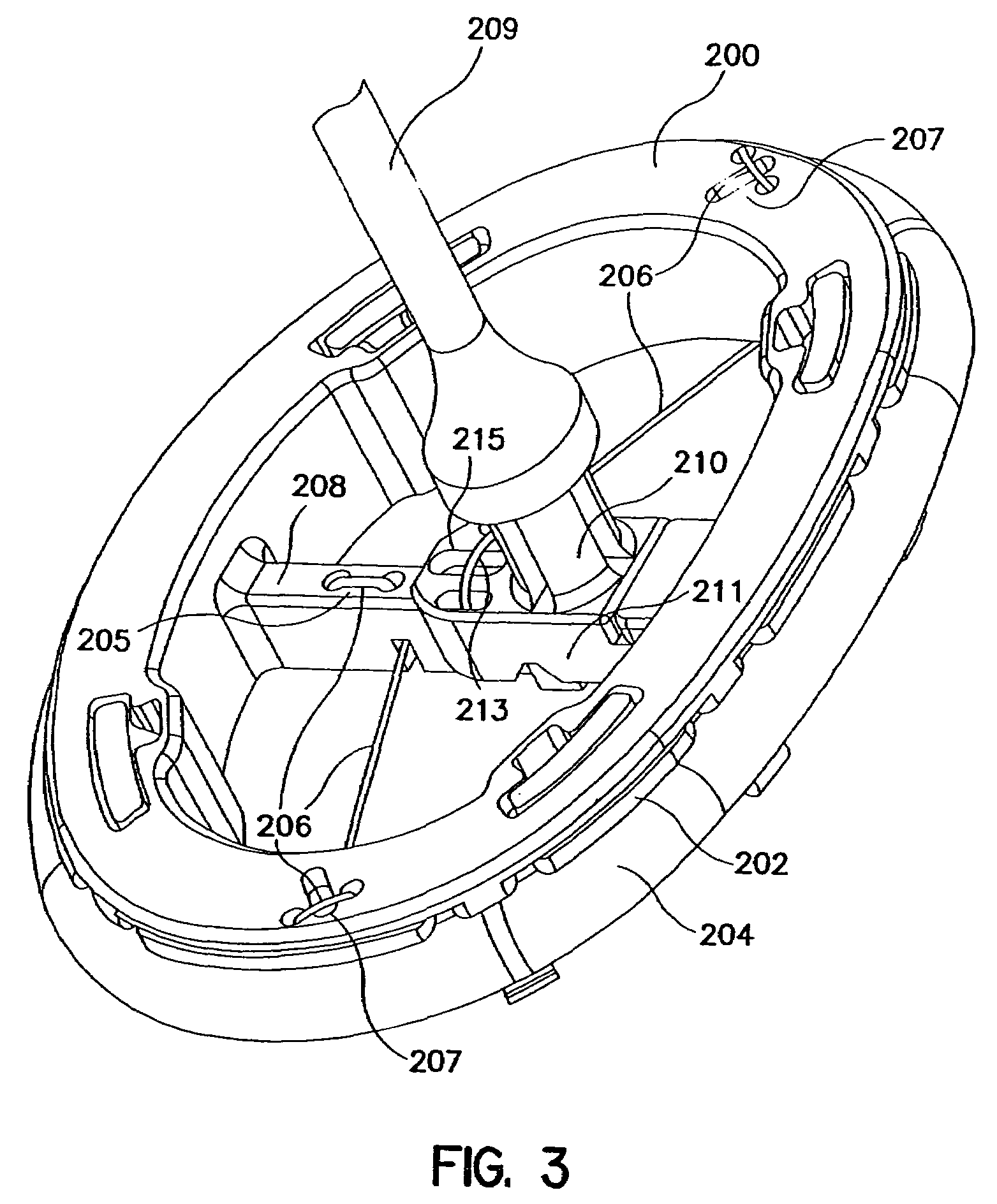 Flexible annuloplasty prosthesis and holder