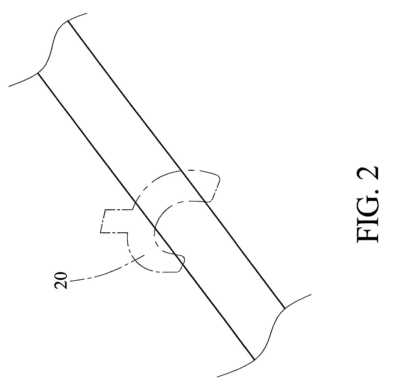 Endovascular stent insertion method