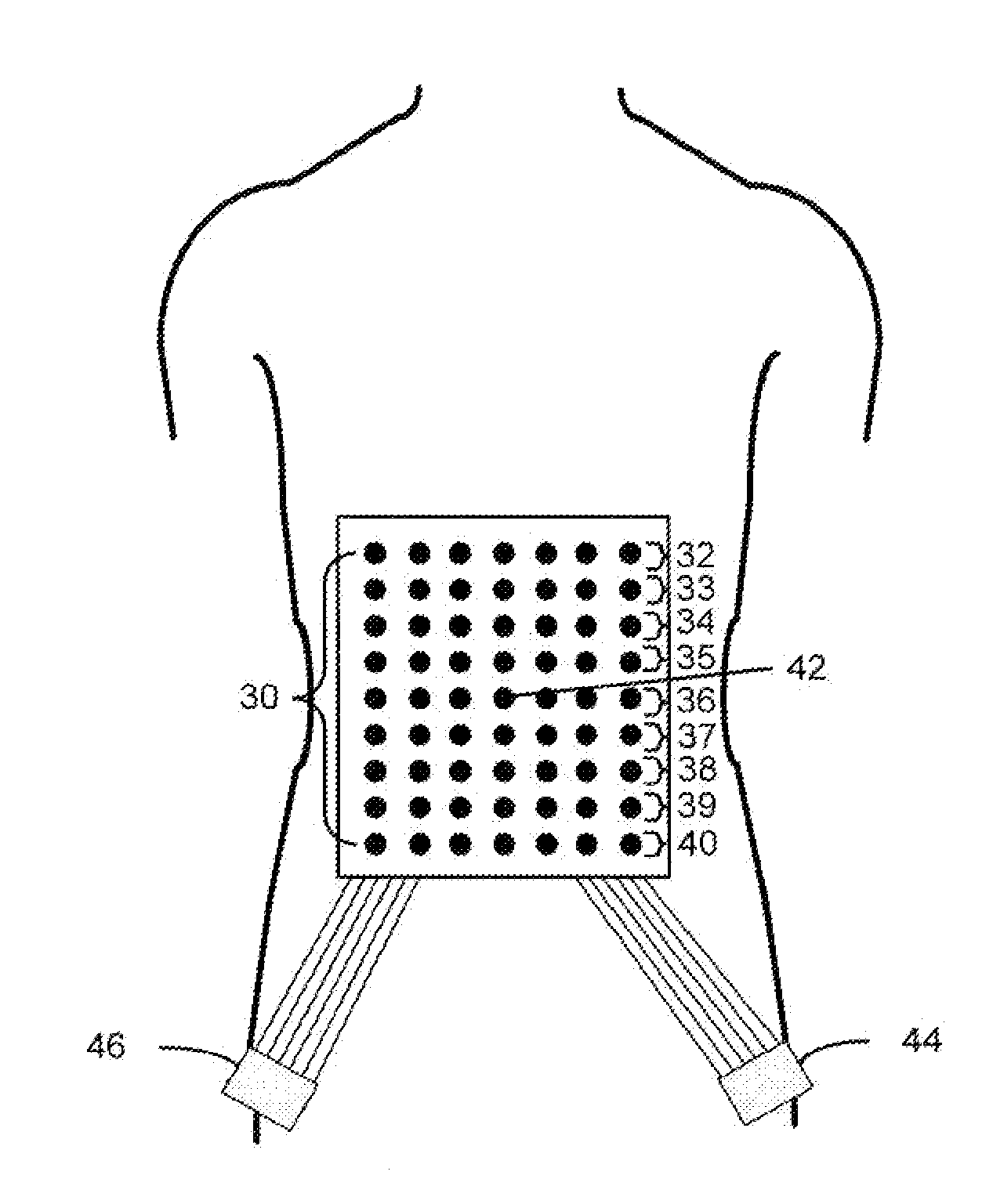 Prediction of clinical outcome using large array surface myoelectric potentials